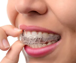 Invisalign Cherry Hill Dental Center